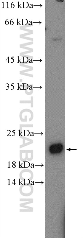 Western Blot (WB) analysis of K-562 cells using C1orf93 Polyclonal antibody (26304-1-AP)