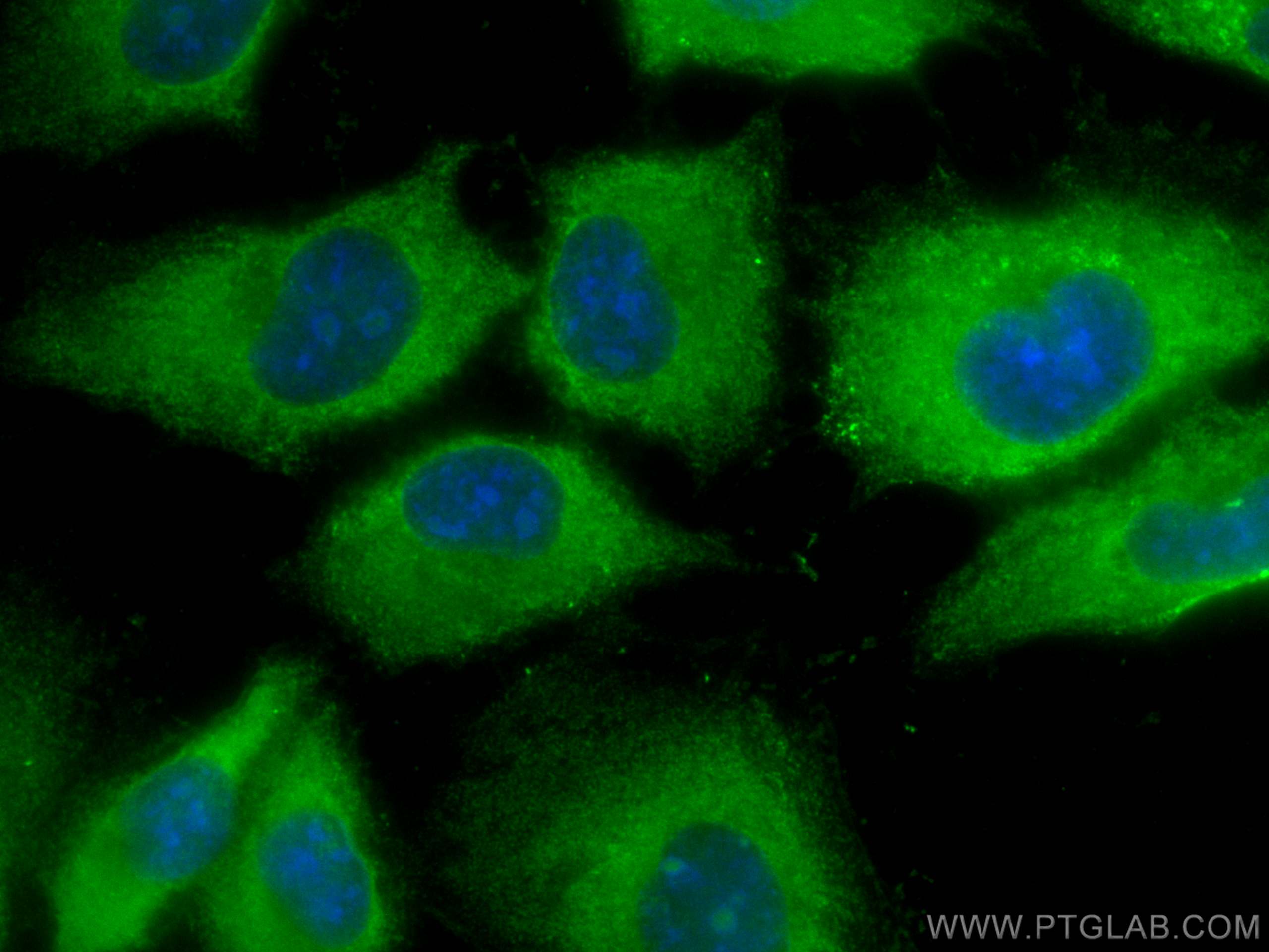 Immunofluorescence (IF) / fluorescent staining of HUVEC cells using CoraLite® Plus 488-conjugated C1qC Monoclonal anti (CL488-66268)