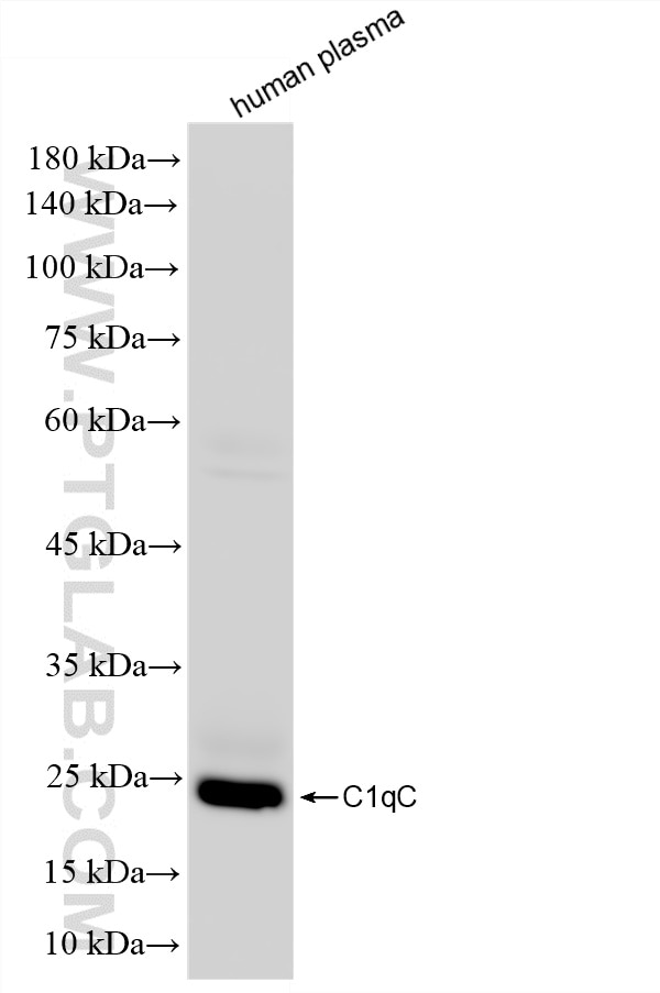 Western Blot (WB) analysis of human plasma using HRP-conjugated C1qC Recombinant monoclonal antibod (HRP-85031-5)