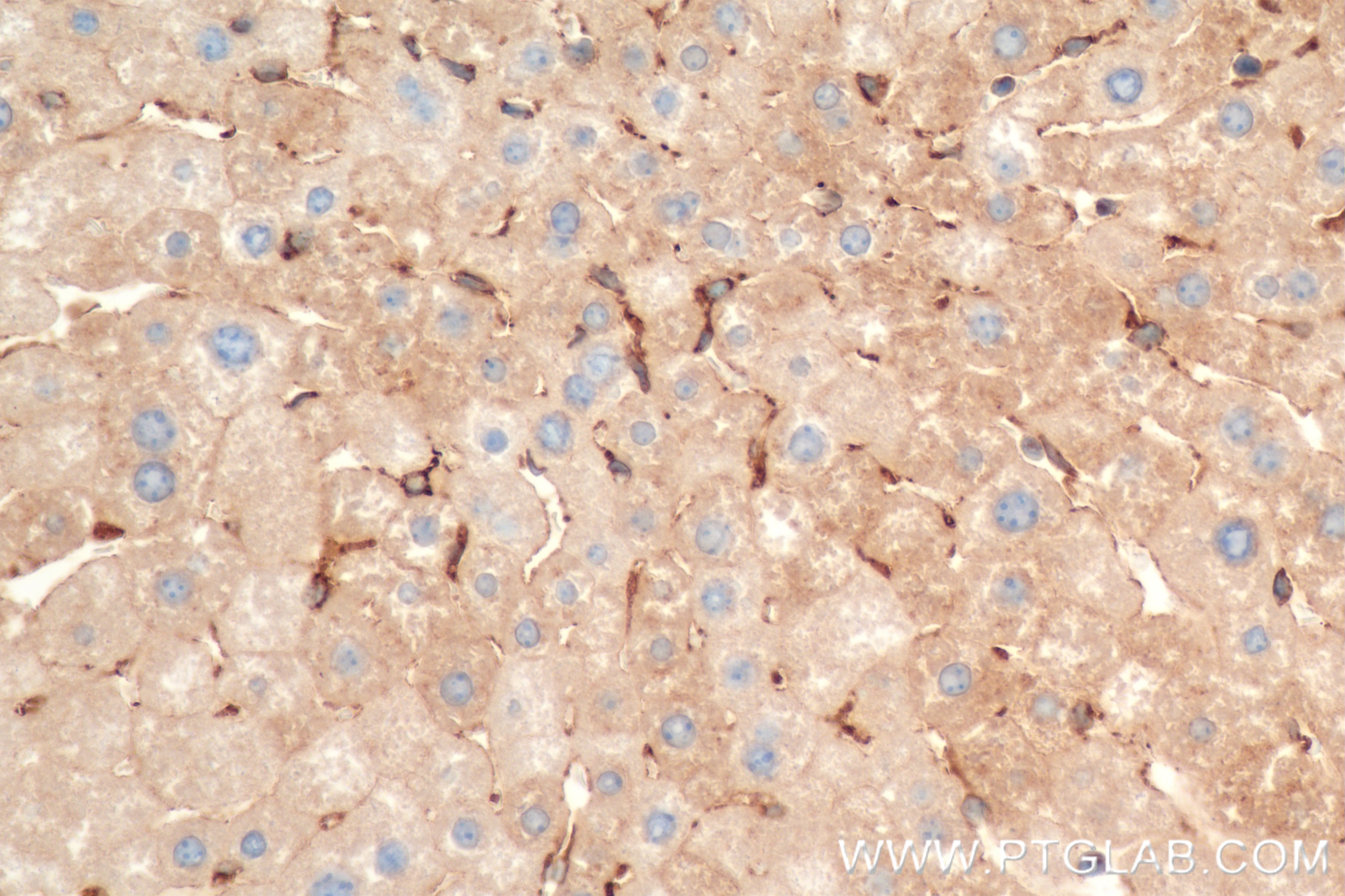 Immunohistochemistry (IHC) staining of mouse liver tissue using C1r Recombinant antibody (85029-4-RR)