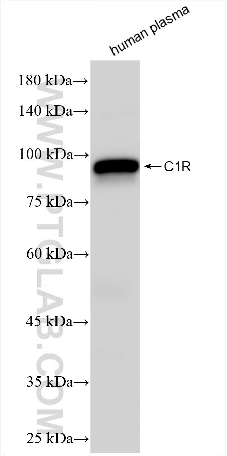 Western Blot (WB) analysis of human plasma using C1r Recombinant antibody (85029-4-RR)