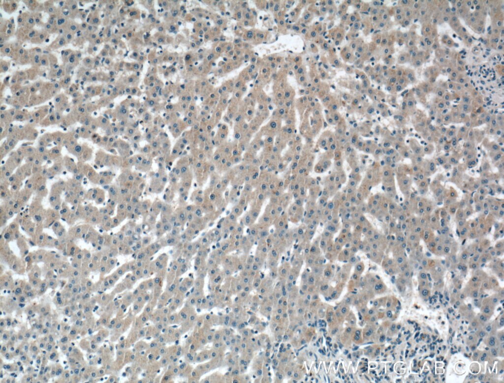 Immunohistochemistry (IHC) staining of human liver tissue using C2 Polyclonal antibody (27175-1-AP)