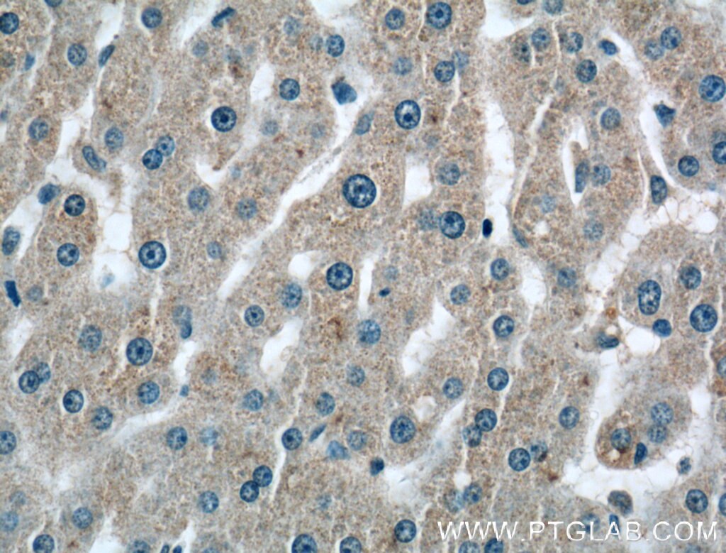 Immunohistochemistry (IHC) staining of human liver tissue using C2 Polyclonal antibody (27175-1-AP)