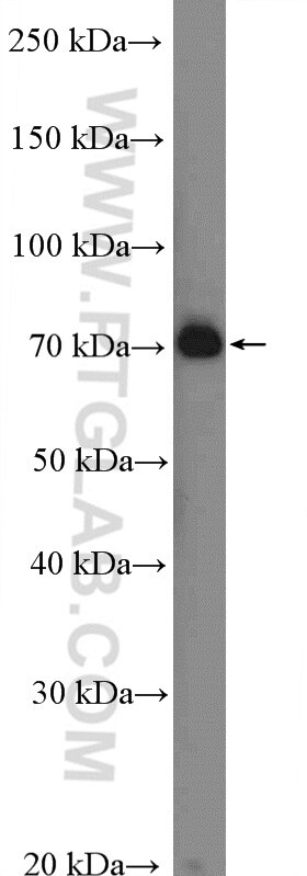 Western Blot (WB) analysis of A431 cells using C2 Polyclonal antibody (27175-1-AP)