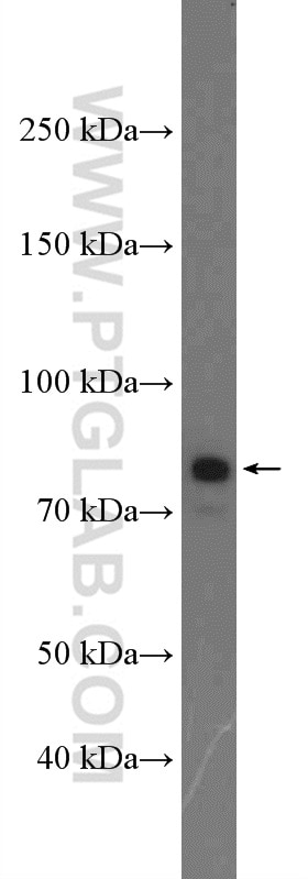 Western Blot (WB) analysis of HepG2 cells using C2 Polyclonal antibody (27175-1-AP)