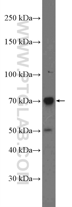 Western Blot (WB) analysis of Raji cells using C2 Polyclonal antibody (27175-1-AP)