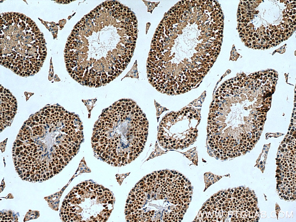IHC staining of mouse testis using 24479-1-AP