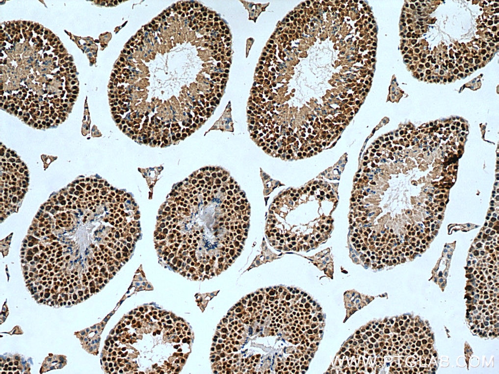 Immunohistochemistry (IHC) staining of mouse testis tissue using GID8 Polyclonal antibody (24479-1-AP)