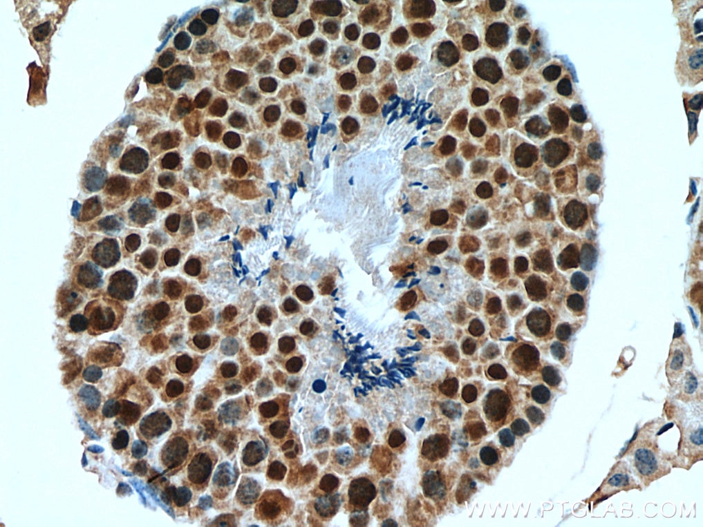 Immunohistochemistry (IHC) staining of mouse testis tissue using GID8 Polyclonal antibody (24479-1-AP)