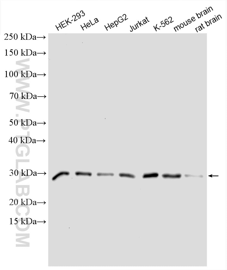 Western Blot (WB) analysis of various lysates using GID8 Polyclonal antibody (24479-1-AP)