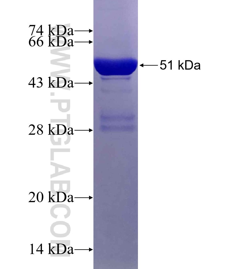 C20orf11 fusion protein Ag19740 SDS-PAGE