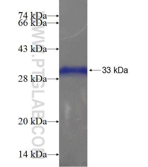 C20orf11 fusion protein Ag19751 SDS-PAGE