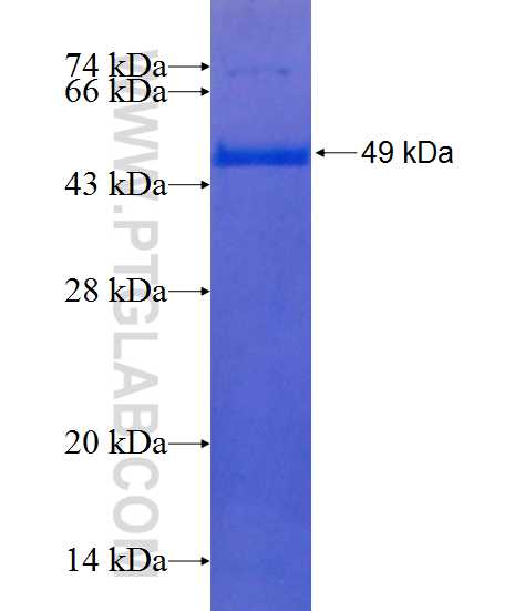 C20orf112 fusion protein Ag20690 SDS-PAGE