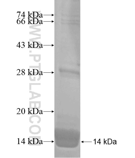 C20orf114 fusion protein Ag20015 SDS-PAGE