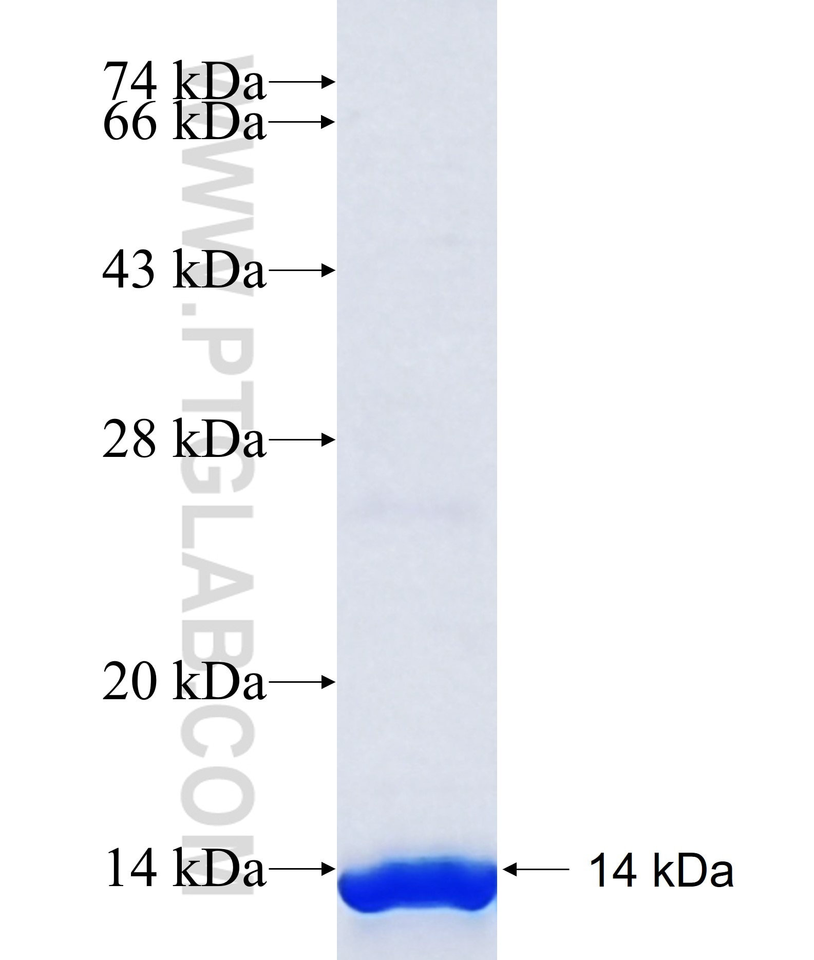 C20orf114 fusion protein Ag20015 SDS-PAGE