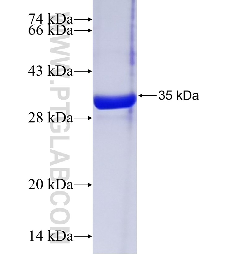C20orf114 fusion protein Ag20056 SDS-PAGE