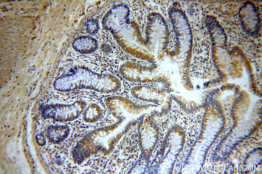 Immunohistochemistry (IHC) staining of human colon tissue using PPDPF Polyclonal antibody (19912-1-AP)