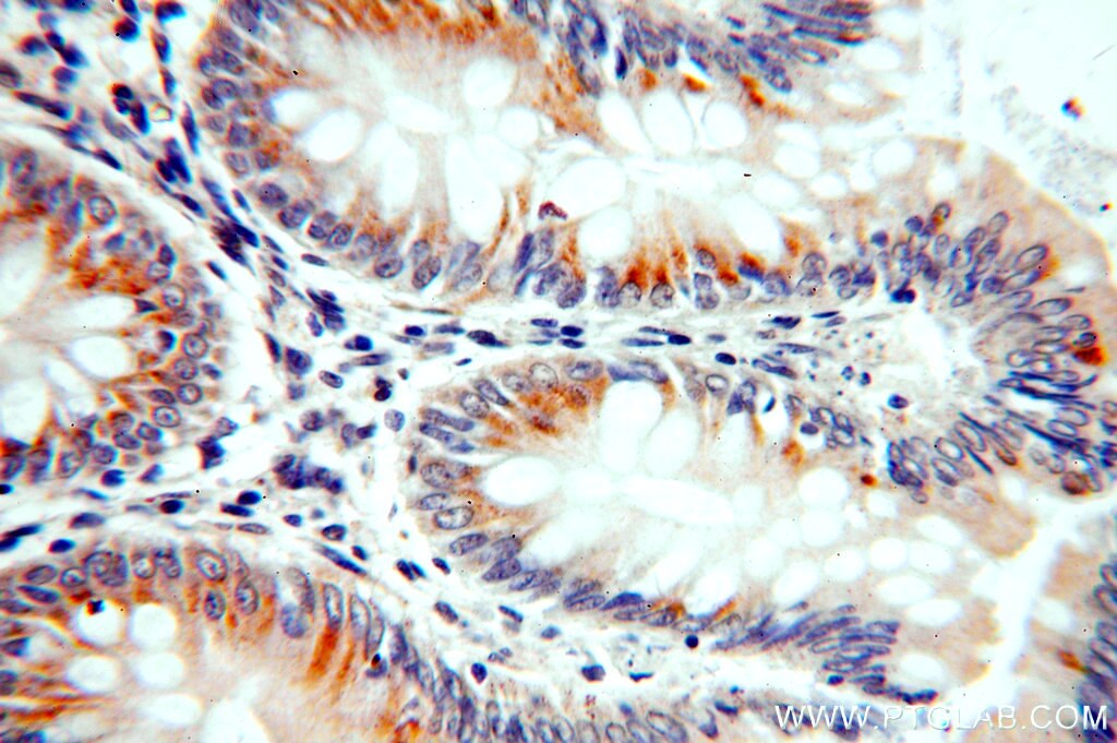 Immunohistochemistry (IHC) staining of human colon tissue using PPDPF Polyclonal antibody (19912-1-AP)