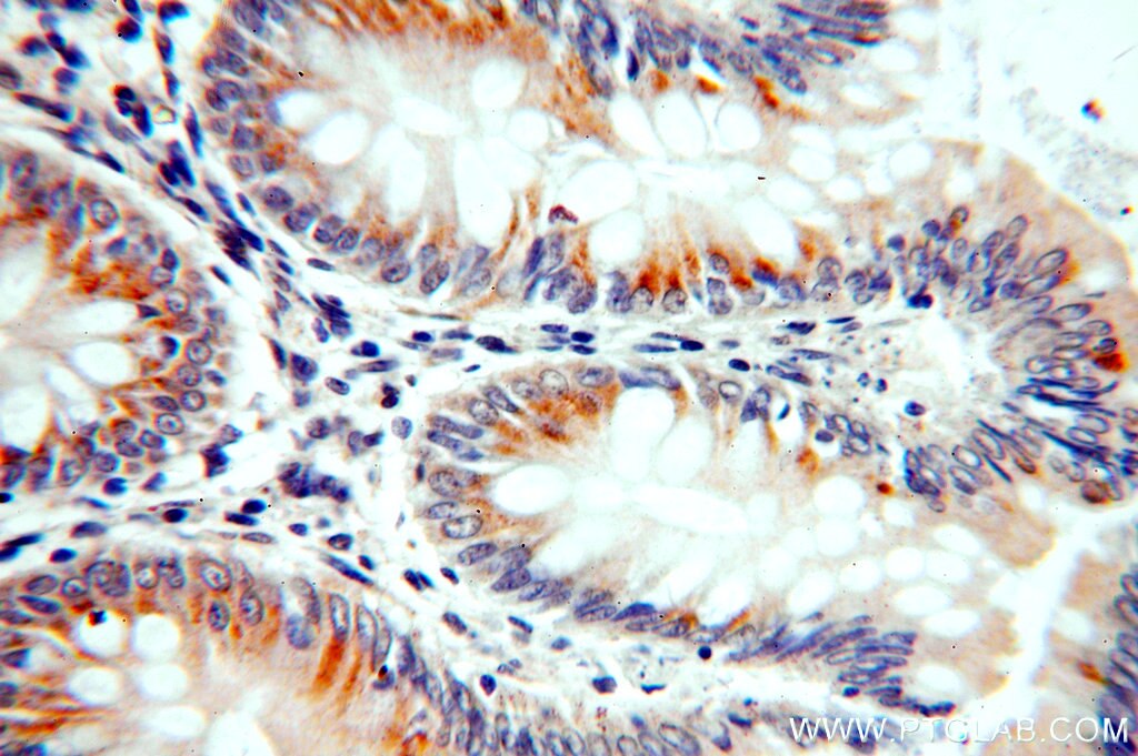 Immunohistochemistry (IHC) staining of human colon tissue using PPDPF Polyclonal antibody (19912-1-AP)