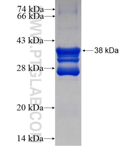 C20orf149 fusion protein Ag13740 SDS-PAGE