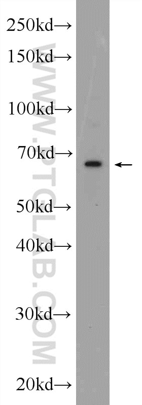 Western Blot (WB) analysis of mouse lung tissue using C20orf152 Polyclonal antibody (24870-1-AP)