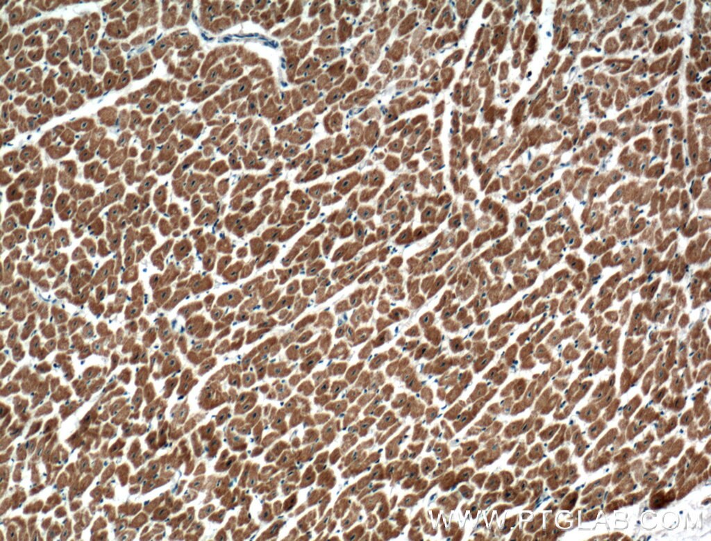 Immunohistochemistry (IHC) staining of human heart tissue using C20orf160 Polyclonal antibody (21493-1-AP)