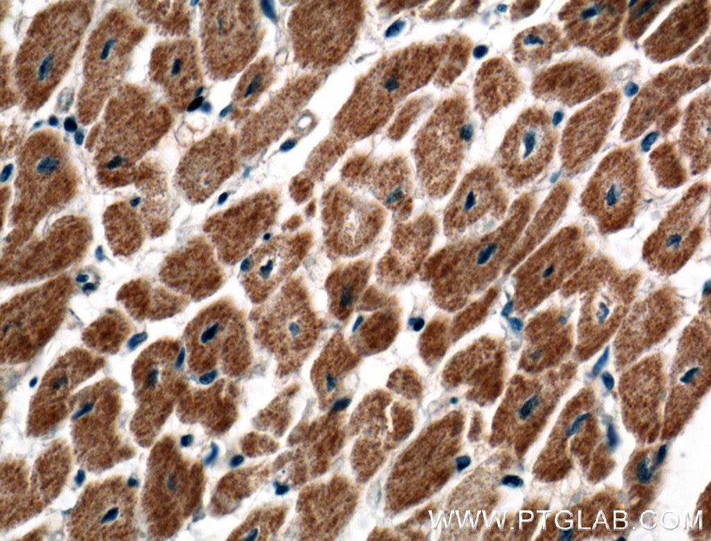 Immunohistochemistry (IHC) staining of human heart tissue using C20orf160 Polyclonal antibody (21493-1-AP)