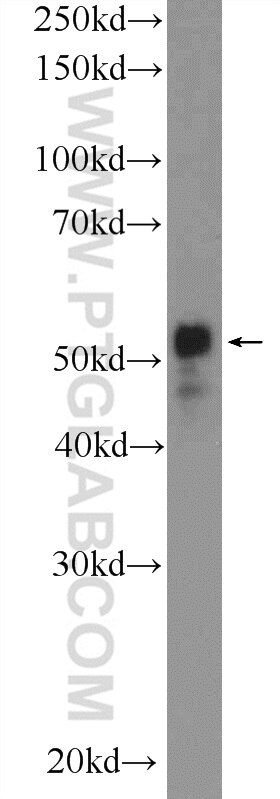 Western Blot (WB) analysis of A431 cells using C20orf160 Polyclonal antibody (21493-1-AP)