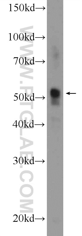 Western Blot (WB) analysis of human placenta tissue using C20orf160 Polyclonal antibody (21493-1-AP)