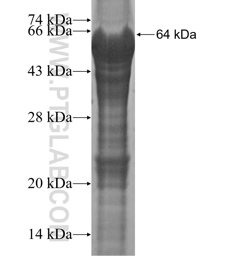 C20orf160 fusion protein Ag15841 SDS-PAGE