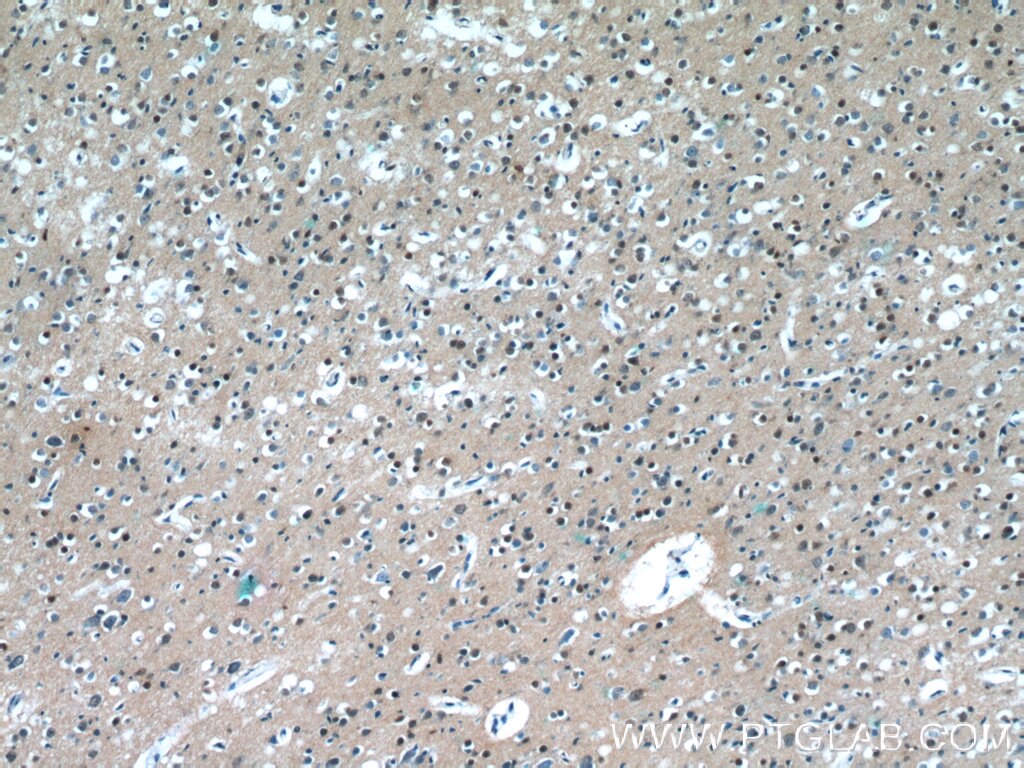 Immunohistochemistry (IHC) staining of human brain tissue using C20orf194 Polyclonal antibody (23184-1-AP)