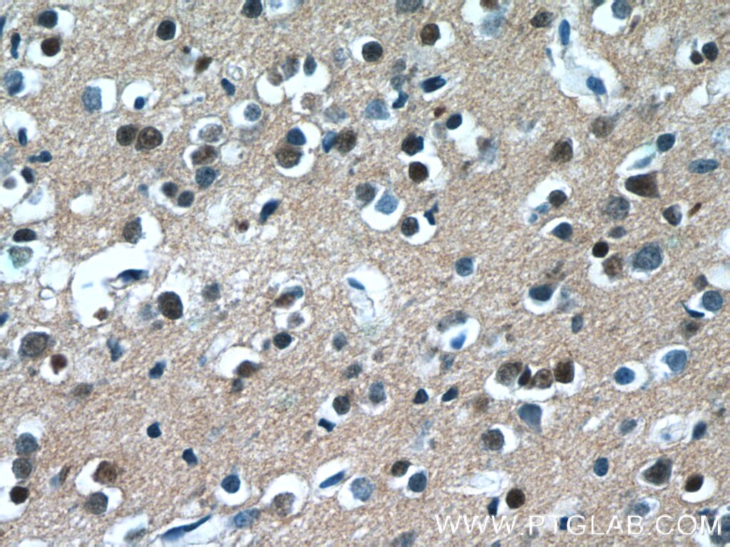 Immunohistochemistry (IHC) staining of human brain tissue using C20orf194 Polyclonal antibody (23184-1-AP)