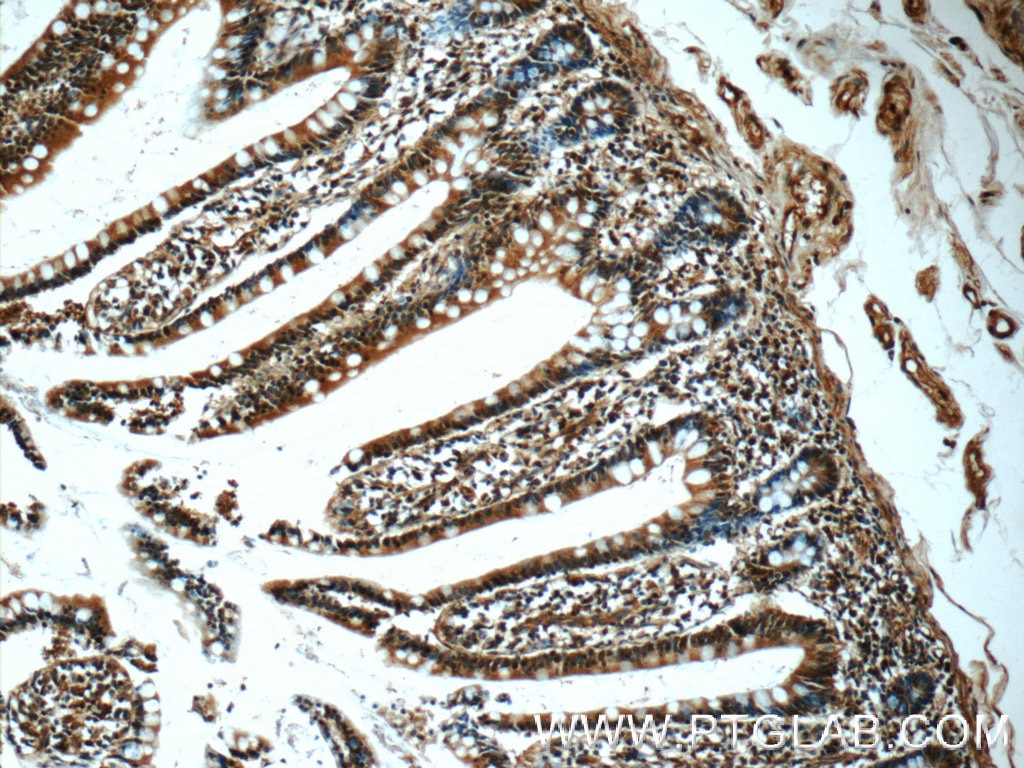 Immunohistochemistry (IHC) staining of human small intestine tissue using C20orf194 Polyclonal antibody (23184-1-AP)