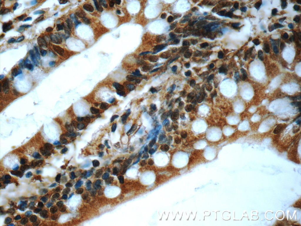 Immunohistochemistry (IHC) staining of human small intestine tissue using C20orf194 Polyclonal antibody (23184-1-AP)