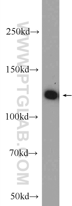Western Blot (WB) analysis of mouse testis tissue using C20orf194 Polyclonal antibody (23184-1-AP)