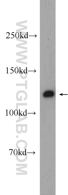 Western Blot (WB) analysis of rat testis tissue using C20orf194 Polyclonal antibody (23184-1-AP)