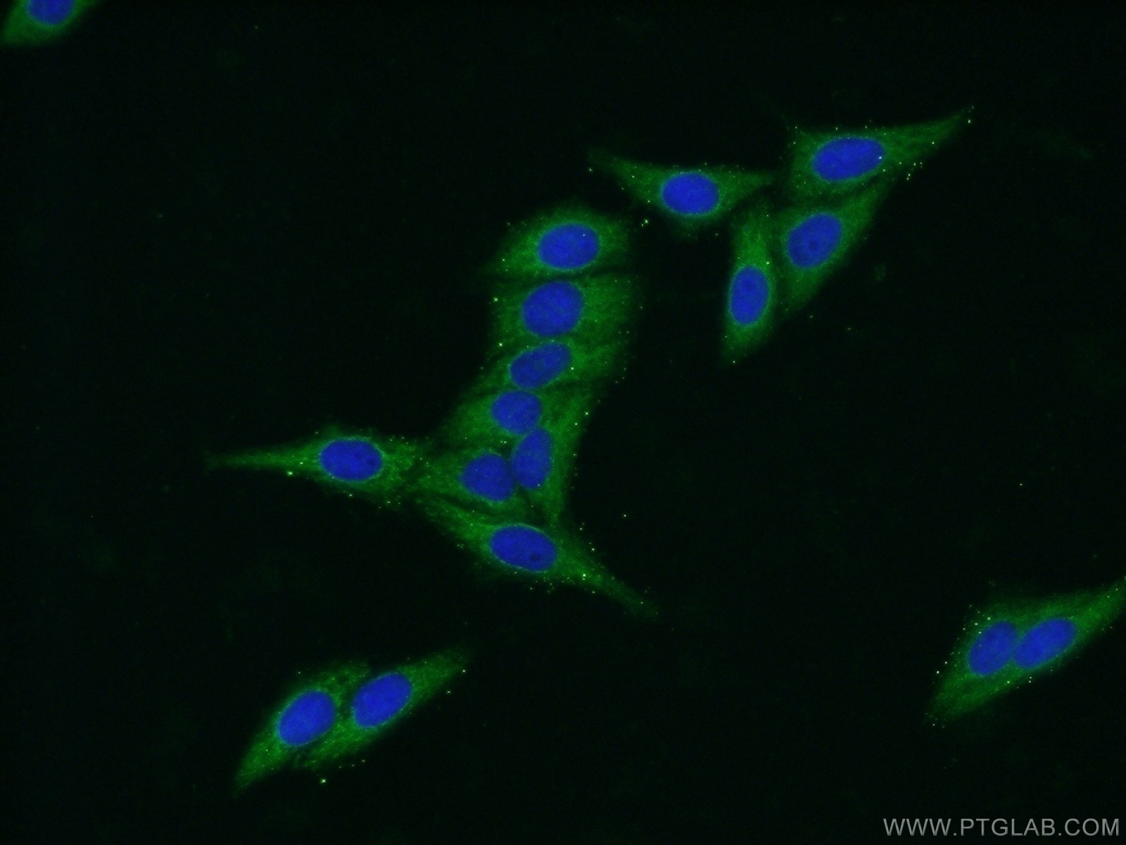 Immunofluorescence (IF) / fluorescent staining of HepG2 cells using C20orf195 Polyclonal antibody (16040-1-AP)
