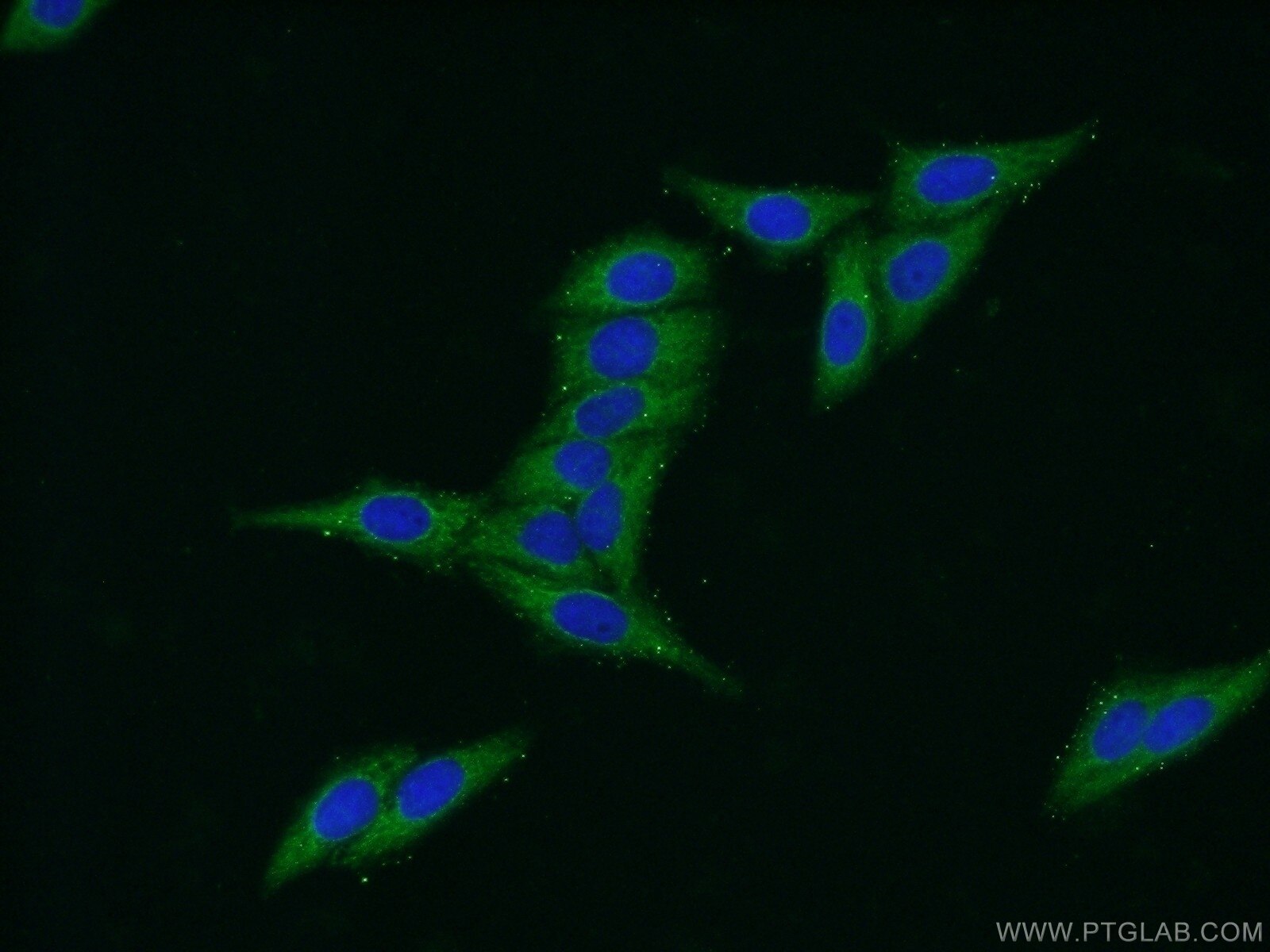 IF Staining of HepG2 using 16040-1-AP