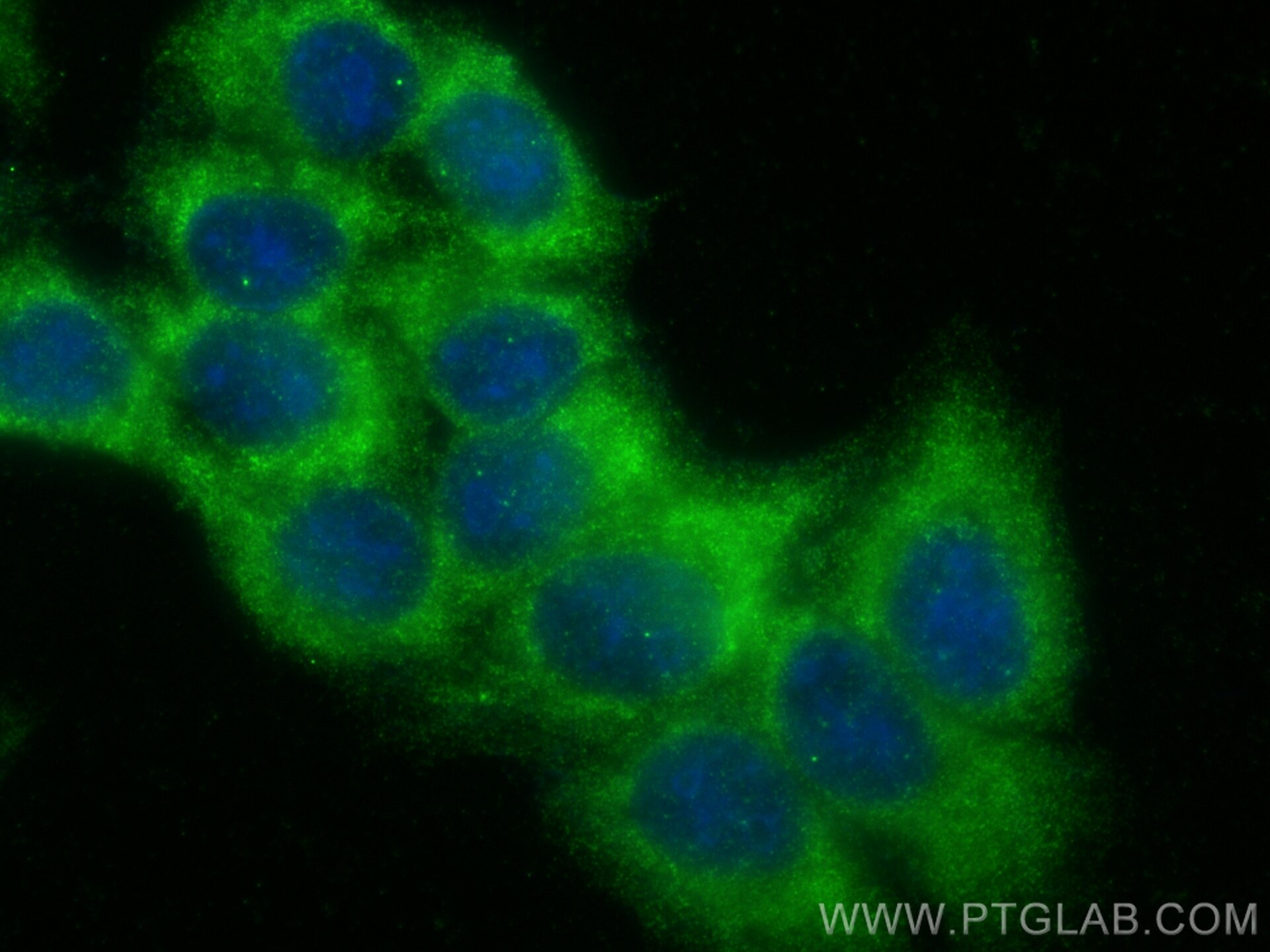 Immunofluorescence (IF) / fluorescent staining of HepG2 cells using C20orf195 Polyclonal antibody (16040-1-AP)