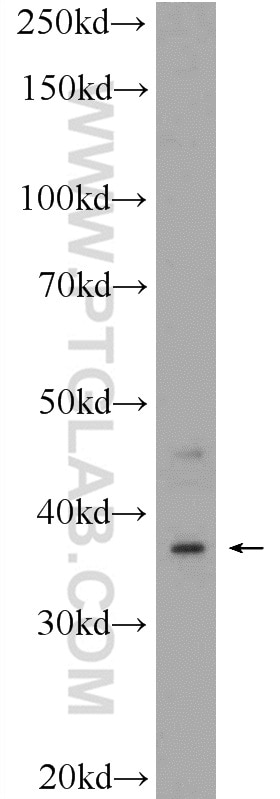 Western Blot (WB) analysis of HepG2 cells using C20orf195 Polyclonal antibody (16040-1-AP)