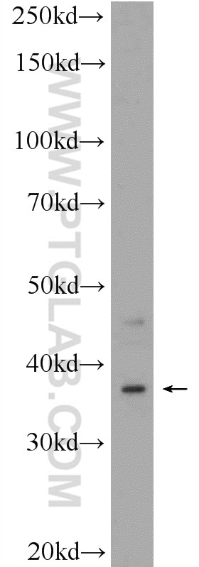 Western Blot (WB) analysis of HepG2 cells using C20orf195 Polyclonal antibody (16040-1-AP)