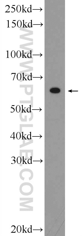 Western Blot (WB) analysis of SMMC-7721 cells using C20orf195 Polyclonal antibody (16040-1-AP)