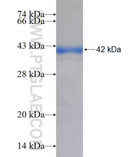 C20orf195 fusion protein Ag9155 SDS-PAGE