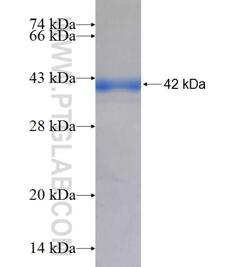 C20orf195 fusion protein Ag9155 SDS-PAGE