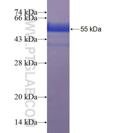 C20orf20 fusion protein Ag22840 SDS-PAGE
