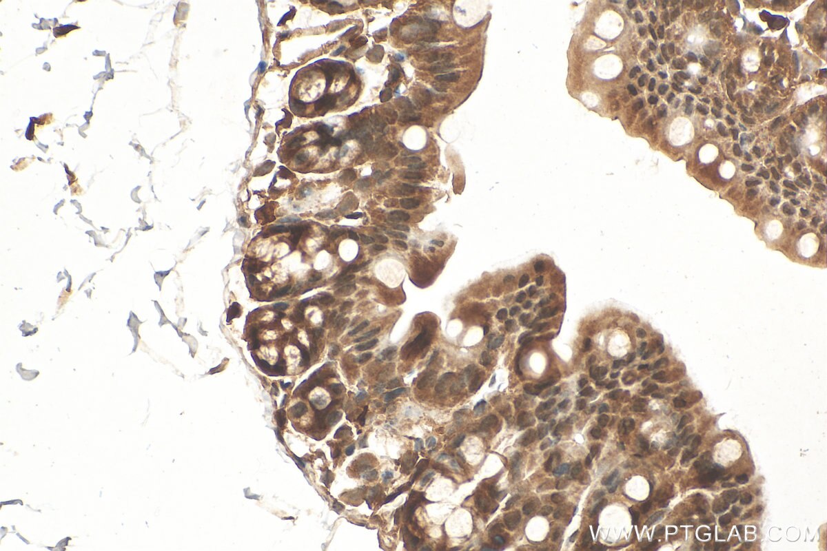 Immunohistochemistry (IHC) staining of mouse colon tissue using C20orf201 Polyclonal antibody (26353-1-AP)