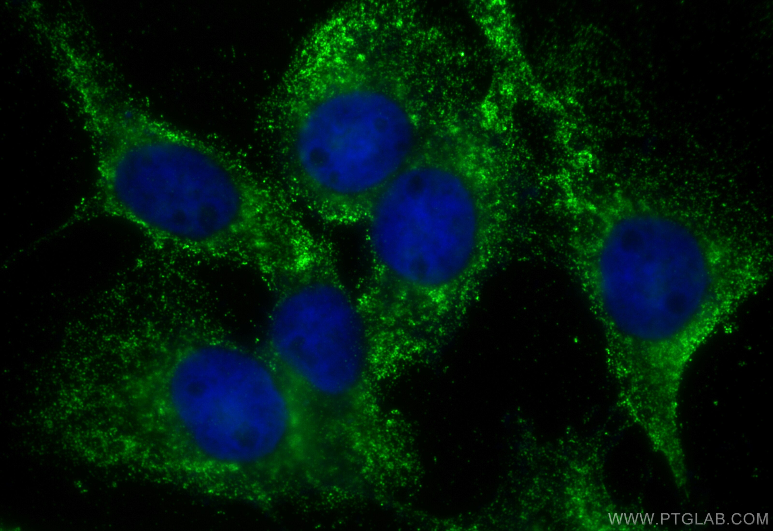 Immunofluorescence (IF) / fluorescent staining of A431 cells using C20orf26 Polyclonal antibody (31427-1-AP)