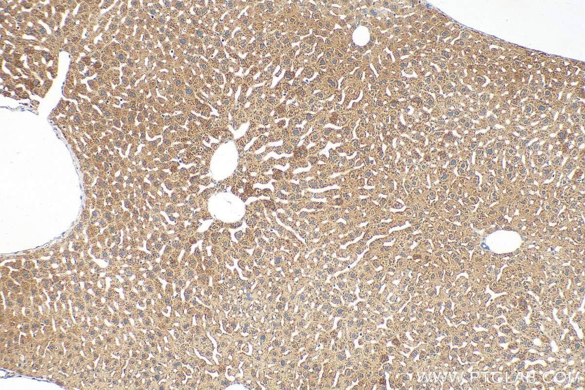 Immunohistochemistry (IHC) staining of mouse liver tissue using C20orf26 Polyclonal antibody (31427-1-AP)