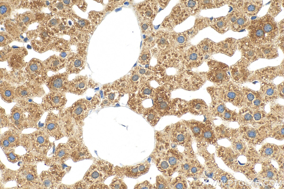 Immunohistochemistry (IHC) staining of mouse liver tissue using C20orf26 Polyclonal antibody (31427-1-AP)