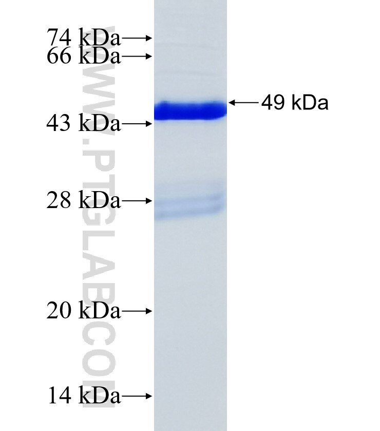 C20orf26 fusion protein Ag35425 SDS-PAGE